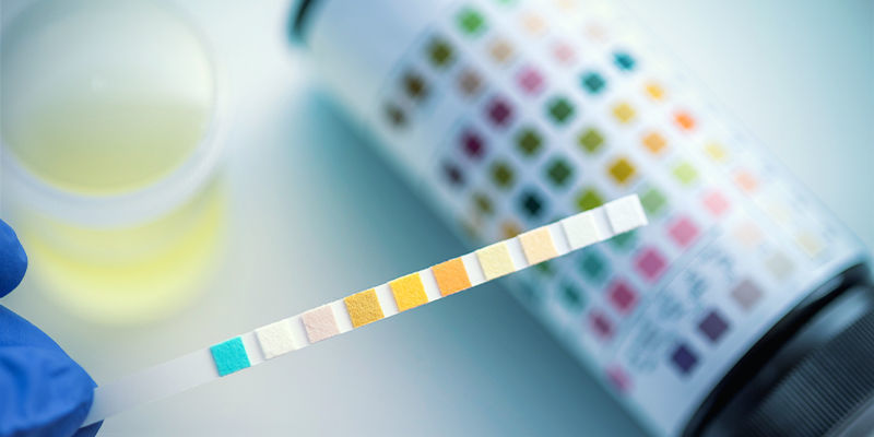 Dopingtest i sport: THC og CBD Dopingtest i sport: THC og CBD