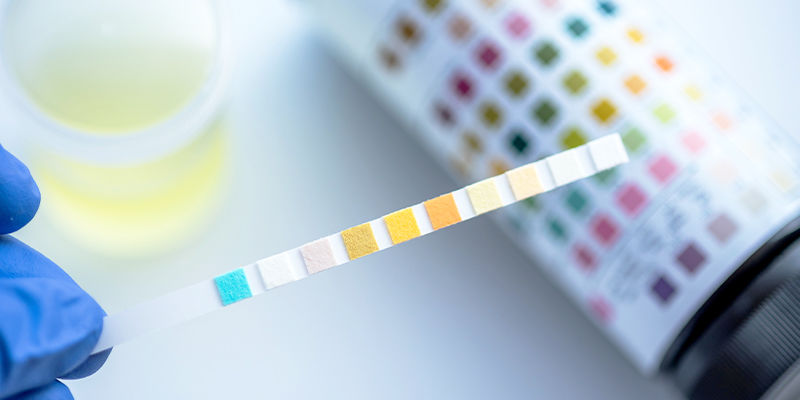 Hvordan virker THC-stoftests? Hvordan virker THC-stoftests?