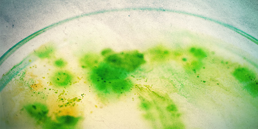 Hvad er alger, og hvordan opstår de? WHAT ARE ALGAE, AND HOW DOES IT DEVELOP?