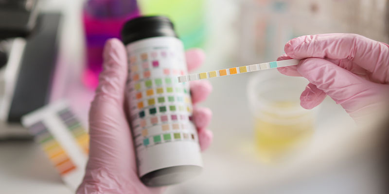 Kratom-stoftest Kratom drug testing