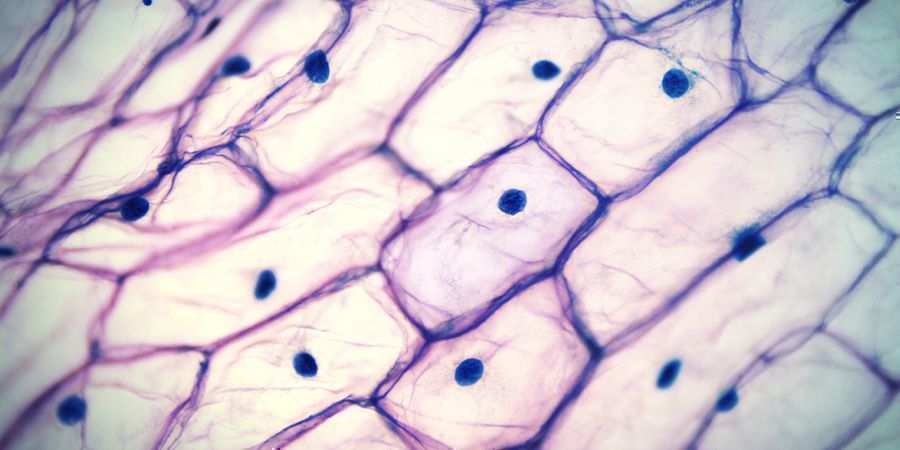 Vakuoler VACUOLES
