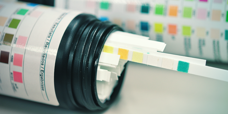 Interaktion mellem CBD-kapsler, stoftests og medicin Interaction Of CBD Capsules With Drug Tests And Medication
