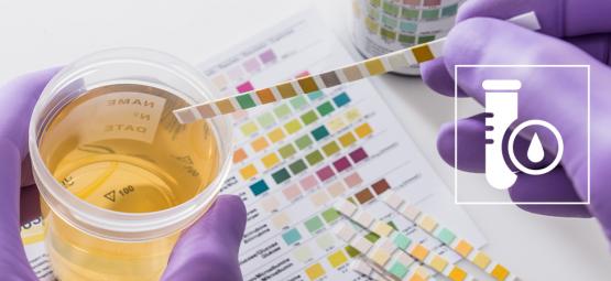 Sådan består du en THC-stoftest (2026)